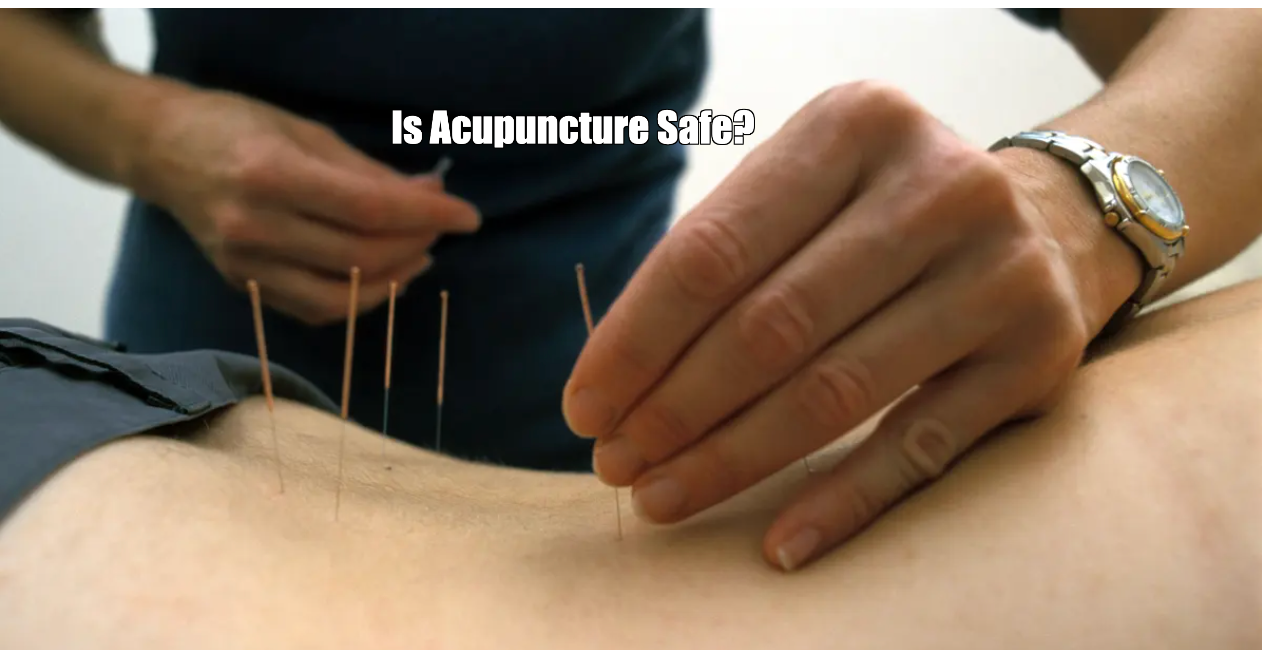 Is Acupuncture Safe?
